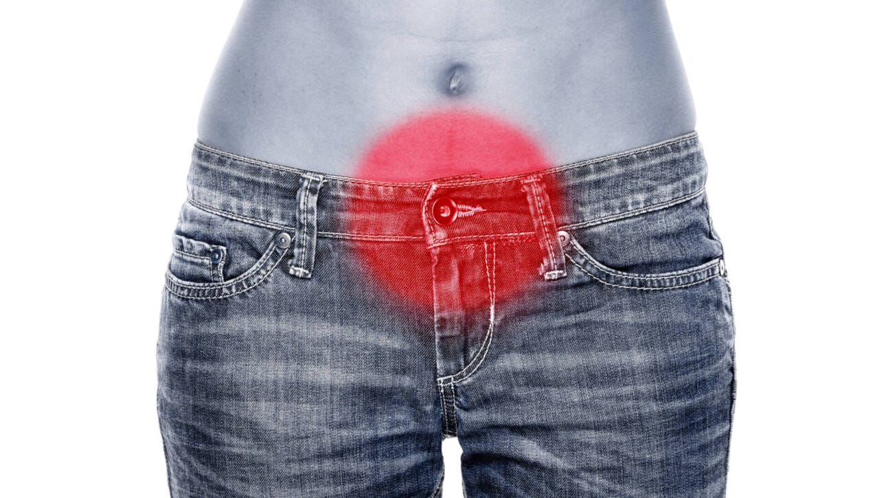 Frau mit Bauchschmerzen, rote Markierung auf der schmerzenden Stelle im Unterbauch. Hormonstörungen. DP @ Maridav