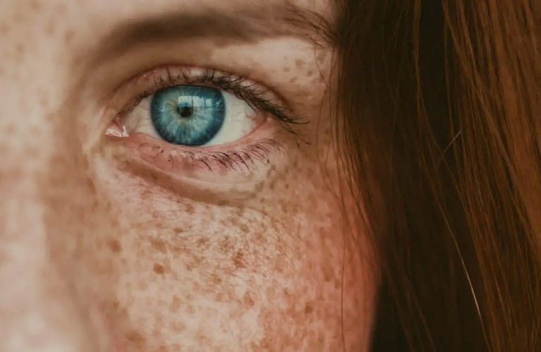 Nahaufnahme eines blauen Auges mit Sommersprossen