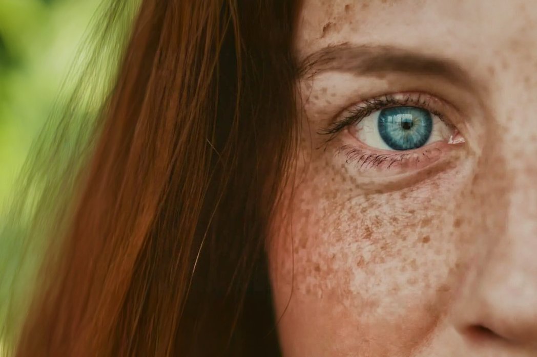 Nahaufnahme eines blauen Auges mit Sommersprossen - der genaue Blick der ViewMed Praxis für ganzheitliche Medizin in Hamburg